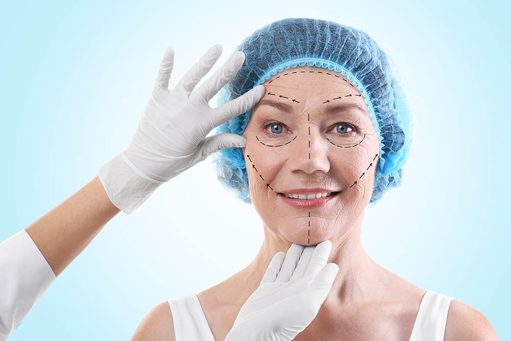 Como é feito o lifting facial? Tire suas dúvidas
